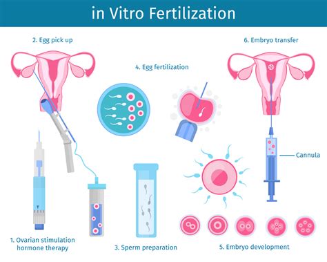 fecundación in vitro-4